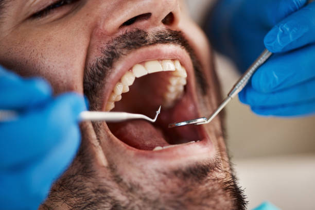 Best Cosmetic Emergency Dentistry in Rotonda, FL
