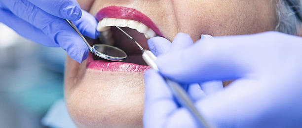 Best Emergency Gum Treatment in Rotonda, FL